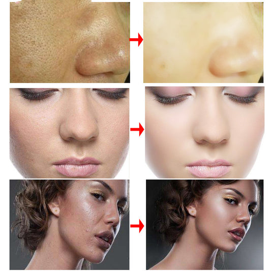 Crema RtopR - Tratamiento Facial Profesional - Image 2