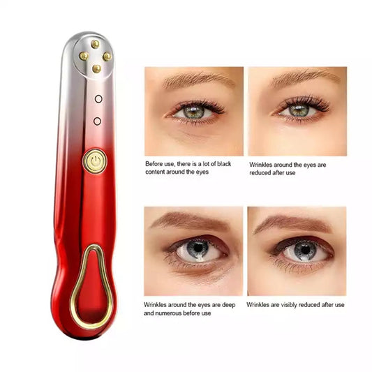 Masajeador Facial RF Anti-Arrugas con Radiofrecuencia y Vibración - Image 2