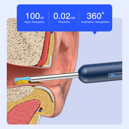 Blue wireless ear endoscope with camera, displaying an ear canal view on a smartphone, with various silicone ear spoon heads, charging cable, and storage jar. - Image 2