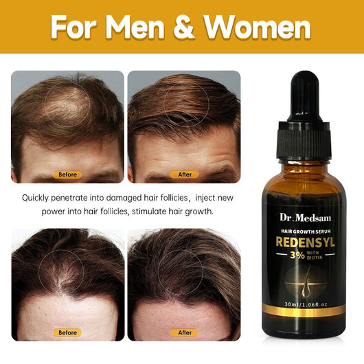 Biotina y Romero para Cabello Grueso y Voluminoso - Image 3