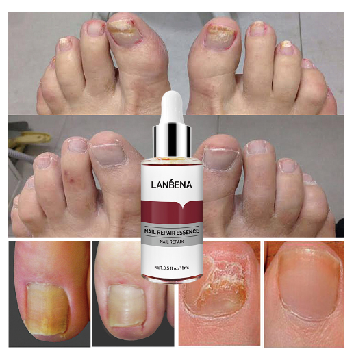 Sérum Reparador de Uñas - Image 3