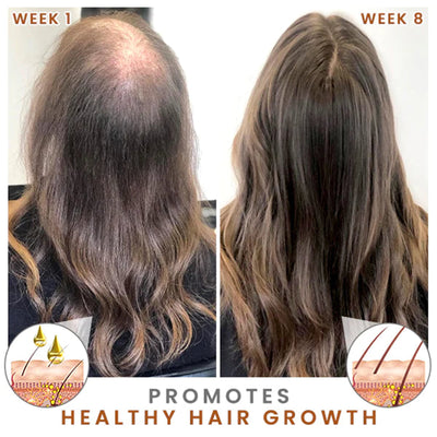 Aceite Densificador Reparador Intenso para Raíces y Cabello Dañado - Image 10