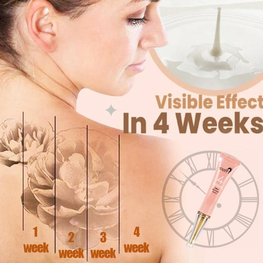 Crema Eliminadora de Tatuajes Máxima Potencia - Remoción Permanente sin Dolor - Image 3