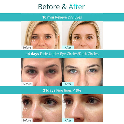 Parches Contorno de Ojos con Radiofrecuencia y Microcorriente - Image 8