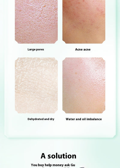 Limpiador Facial Poro Eléctrico Efecto Calor - Image 22