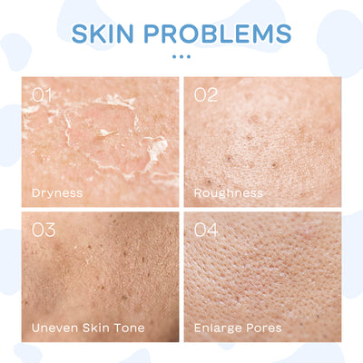 Set de 5 Productos Hidratantes con Leche para el Cuidado Facial - Image 4