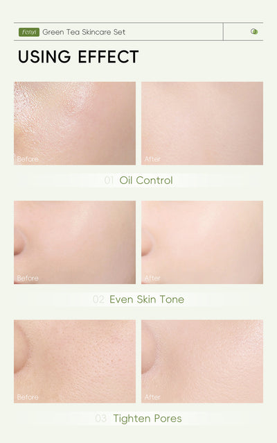 Set de Cuidado Facial con Té Verde - 5 Piezas - Image 9