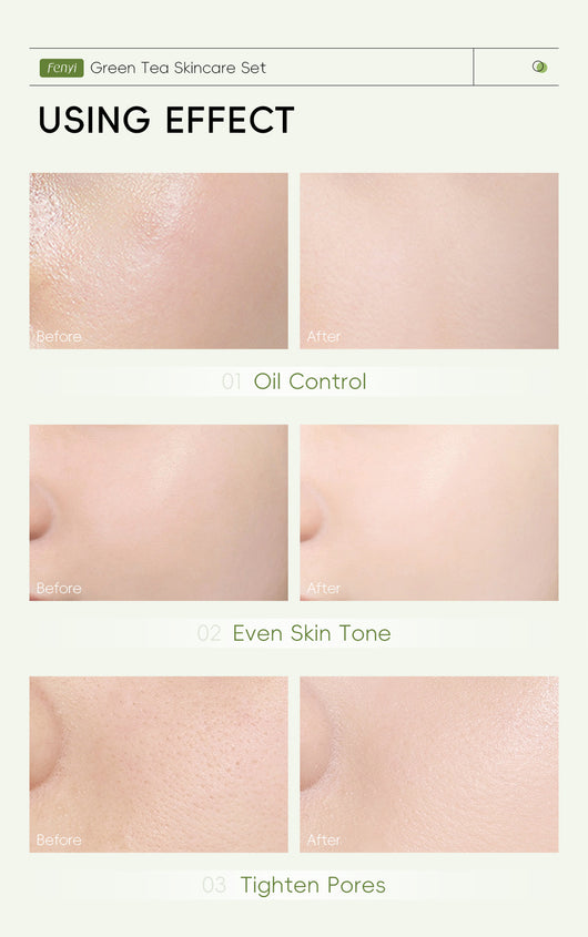 Set de Cuidado Facial con Té Verde - 5 Piezas - Image 9