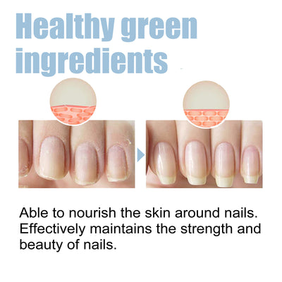 Tratamiento Nutritivo para Uñas de Manos y Pies - Reparación Intensiva y Brillo Natural - Image 14