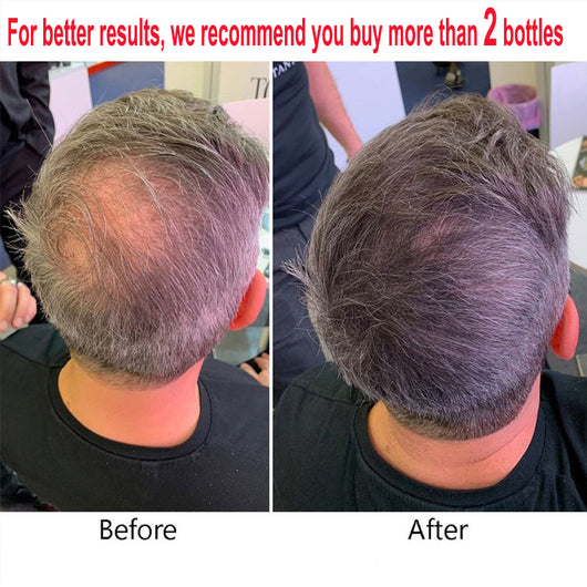 Solución Nutritiva para el Cabello con Jengibre - Image 14