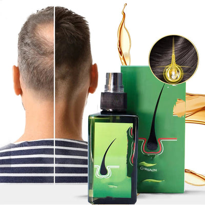 Champú Anticaspa con Reparación y Nutrición Intensiva - Image 2