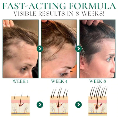 Aceite Esencial para Masaje Facial de Salón de Belleza - Image 12