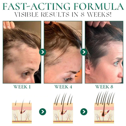 Aceite Esencial para Masaje Facial de Salón de Belleza - Image 12