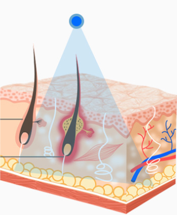 Masajeador Facial con Tecnología de Iones - Image 13