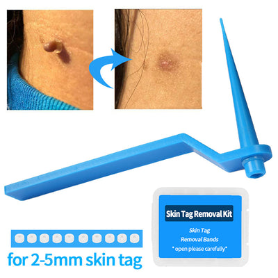 Parches para Uñas Encarnadas - Pack de 10 Tratamientos - Image 10
