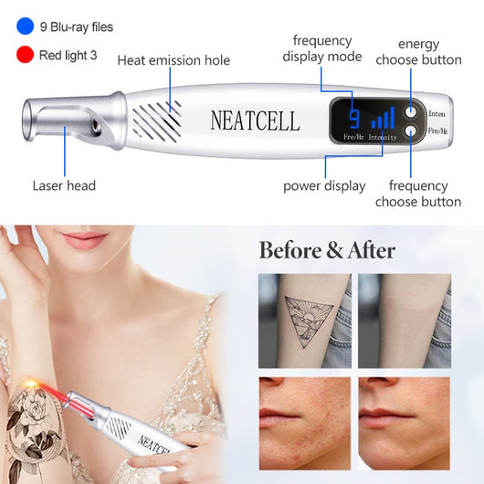 Dispositivo Láser Picosegundo para Eliminar Tatuajes, Cicatrices y Manchas de la Piel - Image 18
