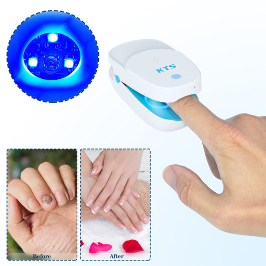 Lámpara de Fototerapia para Hongos en Uñas - Tratamiento LLLT Profesional - Image 8