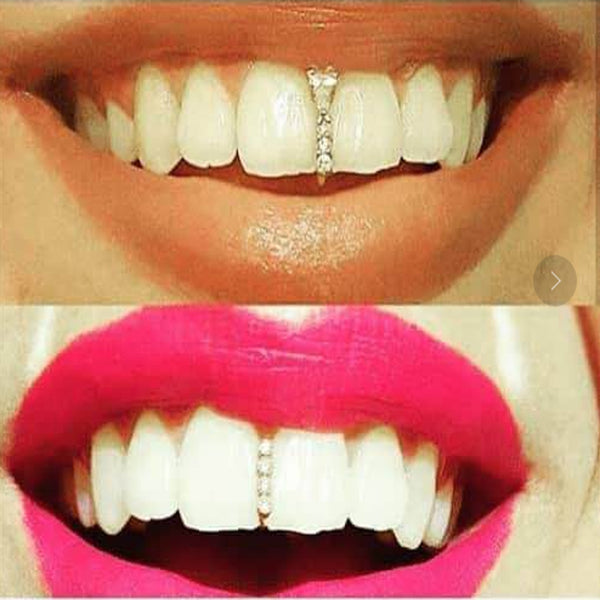Frenos Dentales de Diamante Hip Hop para Halloween