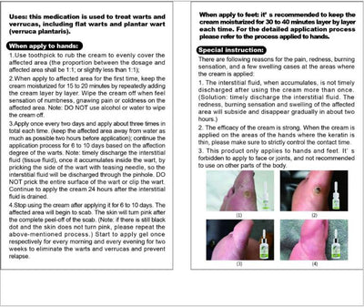 Crema Removedora de Callos y Verrugas Plantares - Parche Médico Profesional - Image 6