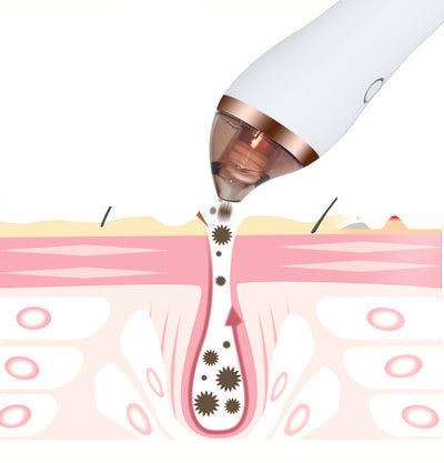 Dispositivo 4 en 1 de Limpieza Facial: Gua Sha, Succión, Extractor de Puntos Negros y Poros Profundos - Image 4