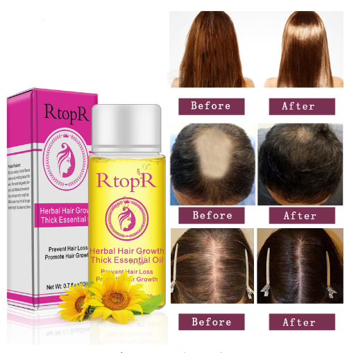 Aceite Esencial Tratamiento Líquido para el Crecimiento del Cabello - Prevención de Caída 20ml