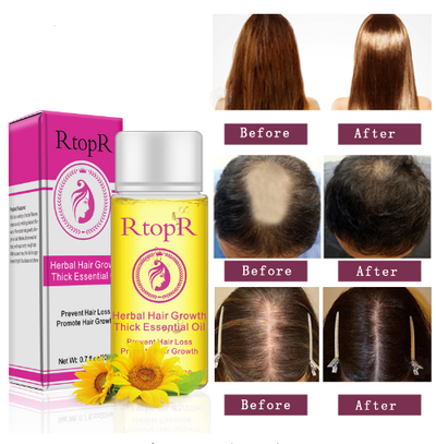 Aceite Esencial Tratamiento Líquido para el Crecimiento del Cabello - Prevención de Caída 20ml