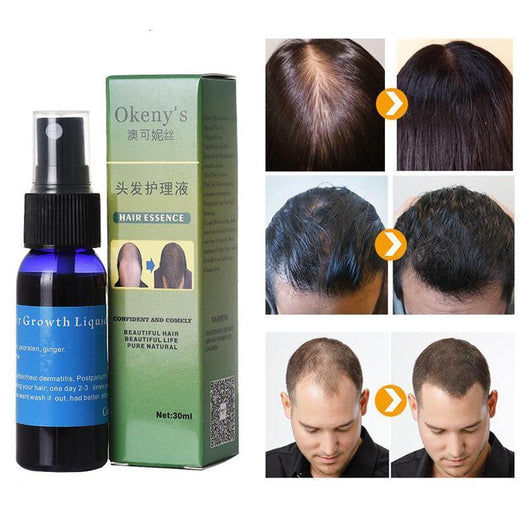 Tratamiento Capilar Sunburst - Suero y Spray Anticaída para Hombre y Mujer - Image 6