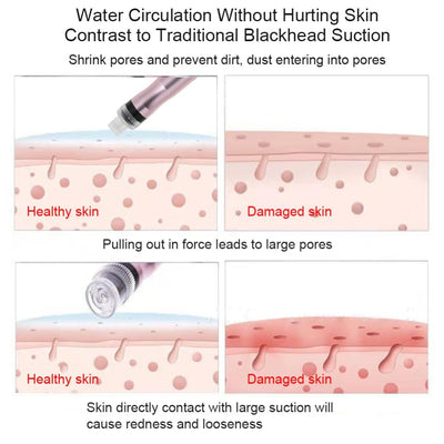 Máquina de Oxígeno e Hidratación con Inyección de Agua para Limpieza Profunda y Rejuvenecimiento Facial - Image 5