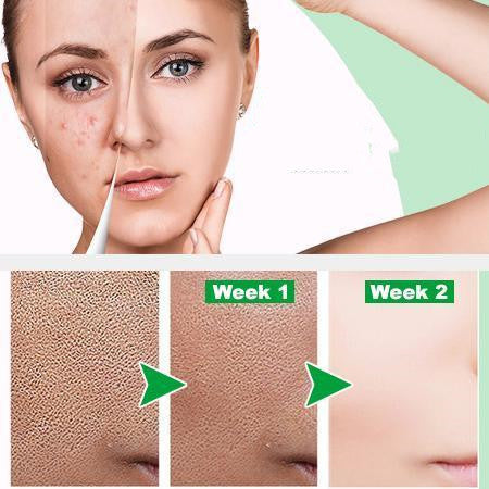 Ácido Lactobiónico Bilin - Exfoliante Suave de Nueva Generación - Image 6