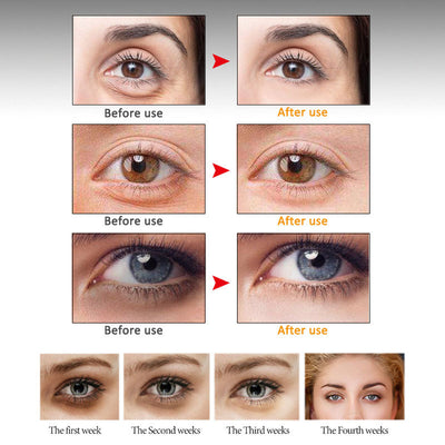 ARTISCARE Crema Antiedad para Contorno de Ojos - Image 3
