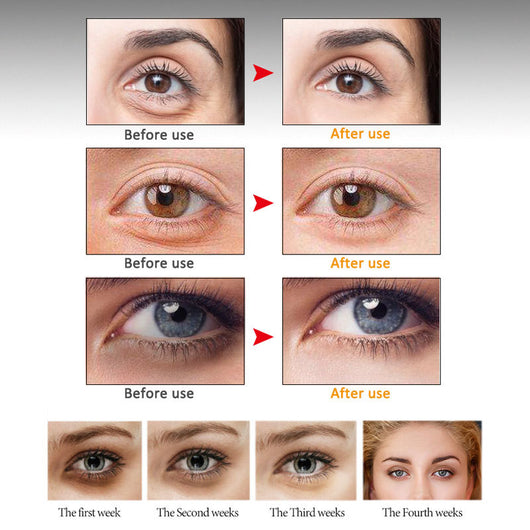 ARTISCARE Crema Antiedad para Contorno de Ojos - Image 3