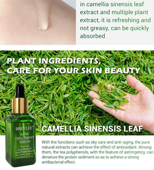Sérum Reparador Anti-Acné con Aceite Facial - Image 4