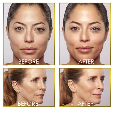 Depiladora Facial Flawless Glo - Removedor de Vello Indoloro - Image 4