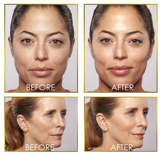 Depiladora Facial Flawless Glo - Removedor de Vello Indoloro - Image 4