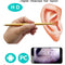 Otoscopio Digital con Cámara de Video HD