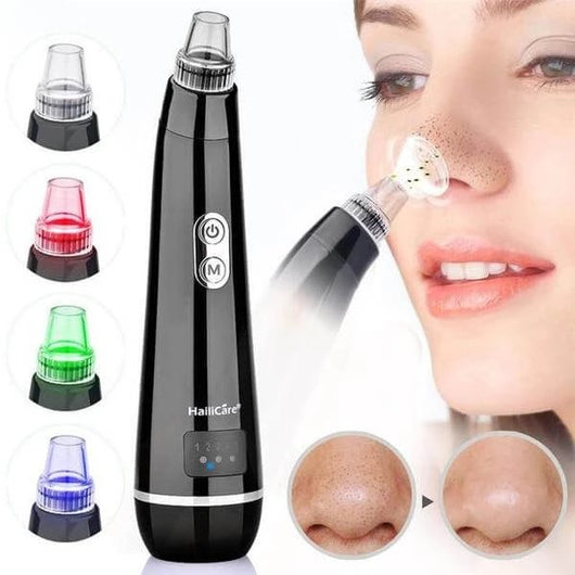 Extractor de Puntos Negros con Luz Tricolor