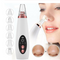 Extractor de Poros Facial - Dispositivo Limpiador de Puntos Negros