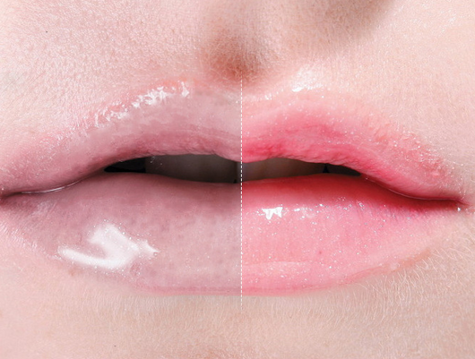 Mascarilla Labial de Aire Comprimido - Image 4