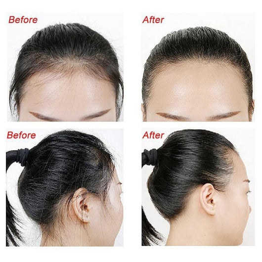 Gel Fijador en Barra para Cabello - Control de Quiebres sin Grasa - Image 15