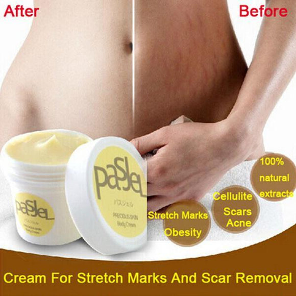 Crema Reductora de Cicatrices y Estrías