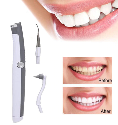 Kit Profesional de Blanqueamiento Dental Sónico con 3 Cabezales LED y Removedor de Sarro - Image 4