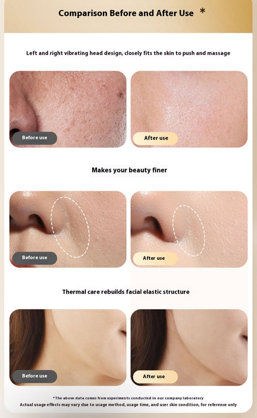 Dispositivo de Microcorriente para Lifting Facial y Contorneado - Image 12