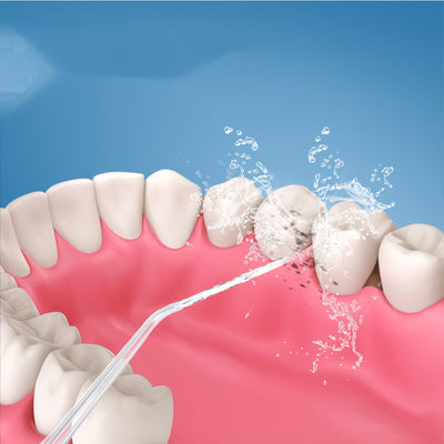 Limpiador Dental Eléctrico Portátil HM-Y828 - Image 5