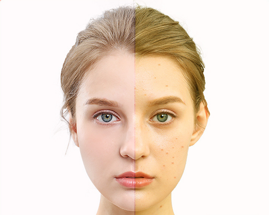 Máscara LED Facial de Fototerapia Multicolor para Rejuvenecimiento en Casa - Image 6