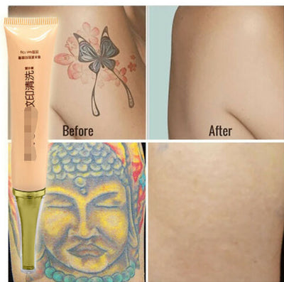 Crema Eliminadora de Tatuajes - Image 4