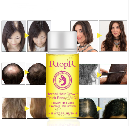 Aceite Esencial Tratamiento Líquido para el Crecimiento del Cabello - Prevención de Caída 20ml - Image 3