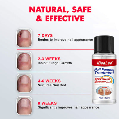 Solución Líquida Bacteriostática Espesante para Onicomicosis - Image 2