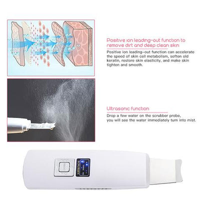 Limpiador Ultrasónico Facial con Masaje Vibratorio - Eliminador de Puntos Negros y Acné - Image 6