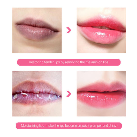 Sérum Aclarador de Labios LANBENA con Loción Hidratante de Cereza - Image 5