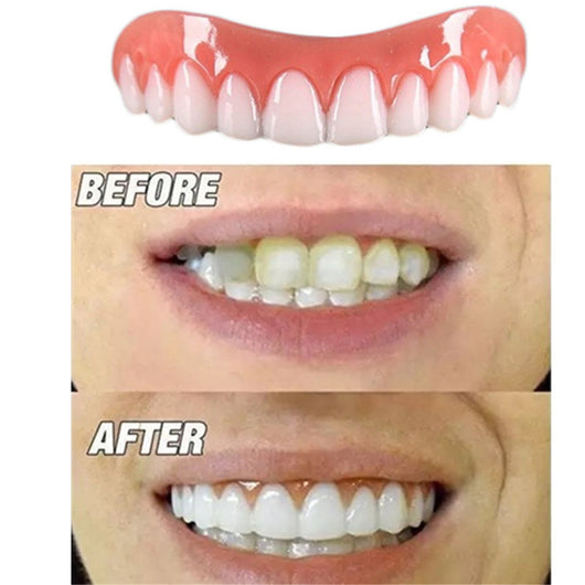 Carillas Dentales de Silicona Premium para Dientes Superiores e Inferiores - Image 11